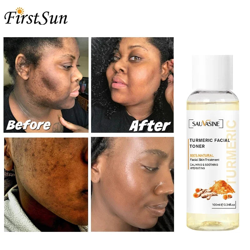 Turmeric lemon Skin Care products Acne Dark Spot Remover Whitening Brighten Facial Serum Face Cream Cleanser Serum Oil Cosmetics