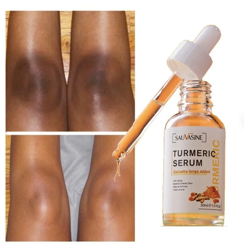 Turmeric lemon Skin Care products Acne Dark Spot Remover Whitening Brighten Facial Serum Face Cream Cleanser Serum Oil Cosmetics